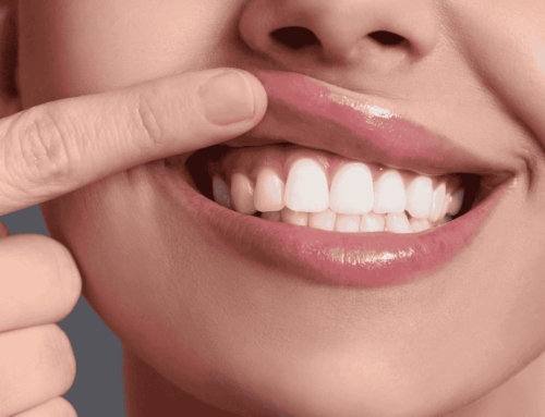Top 7 Signs of Healthy Gums and Why They Matter
