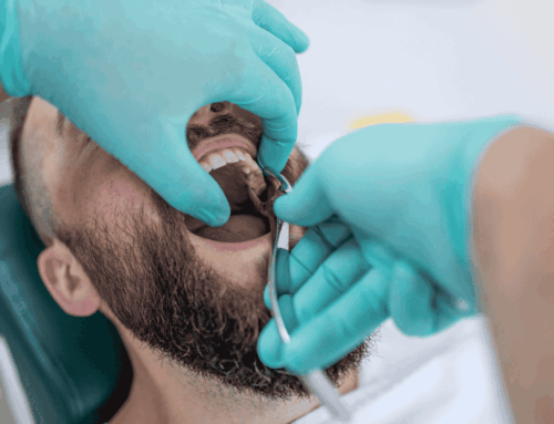 Tooth Extraction Aftercare Instructions: What to Do (and Not Do)